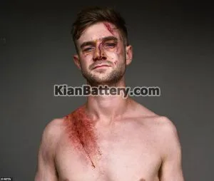 معرفی انواع کمربند ایمنی خودرو 5 آسیب های کمربند ایمنی ماشین